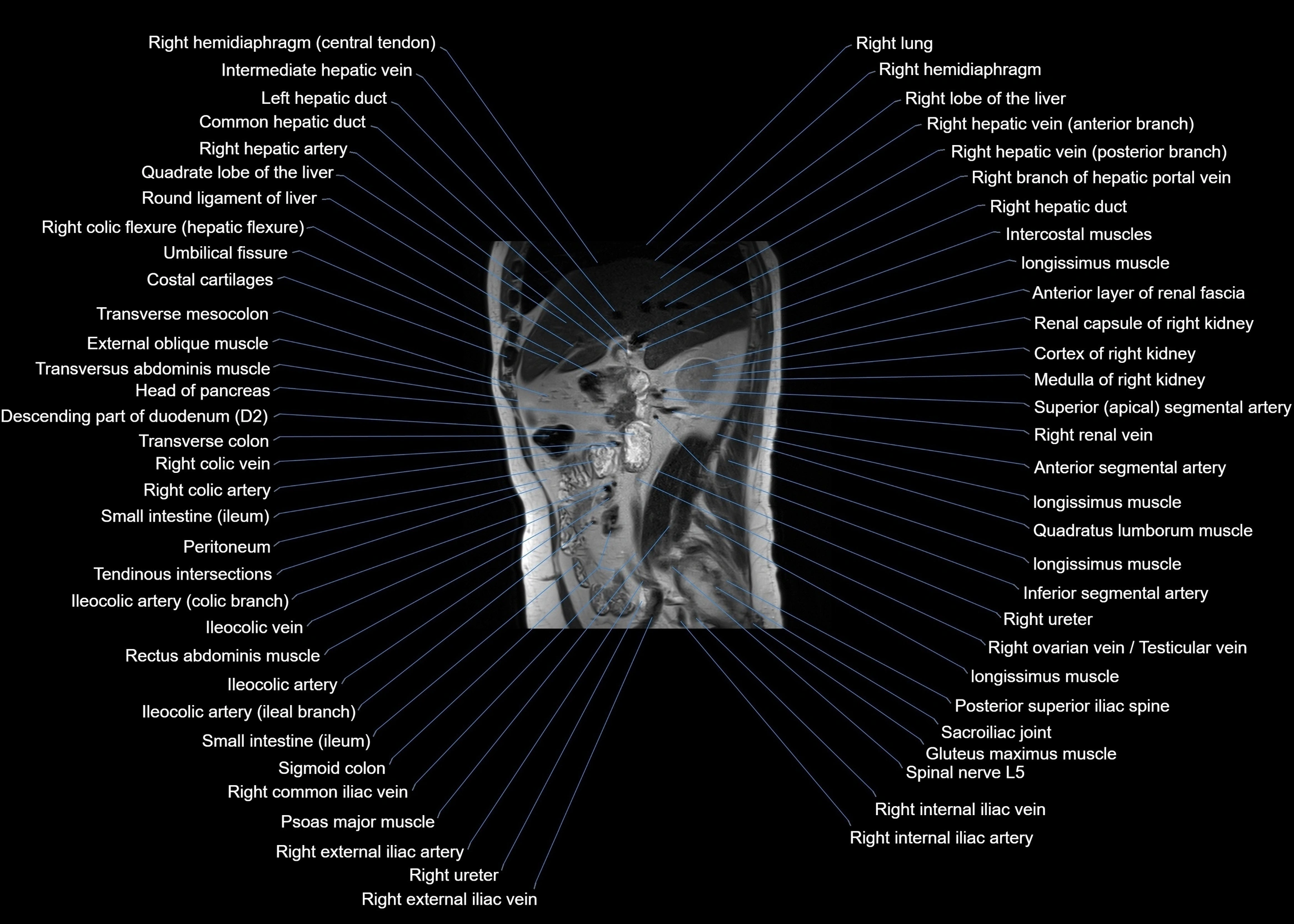 MRI abdomen sagittal cross sectional anatomy  radiology  image-img-00001-00029.webp